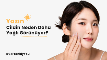 Yazın Cildin Neden Daha Yağlı Görünüyor?