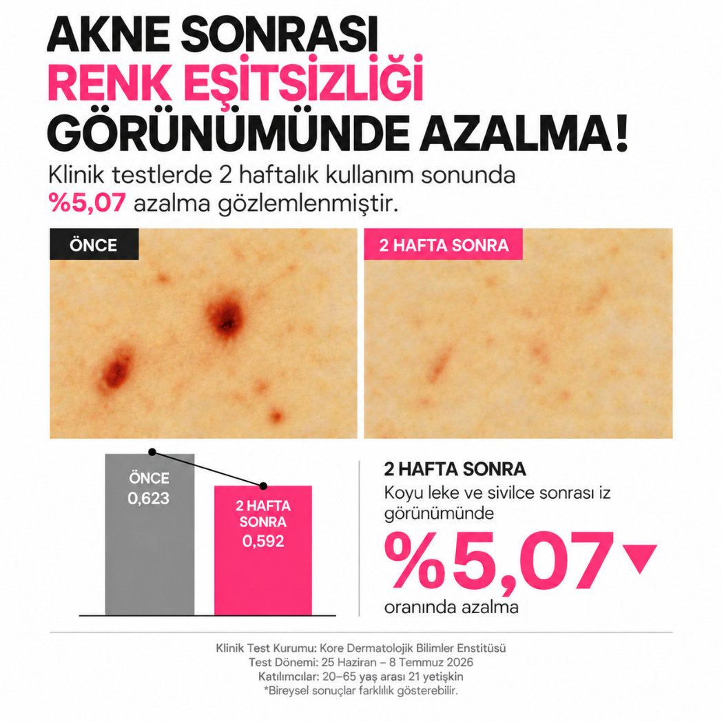 F.A.S.T. Pimple Eraser Roll-On - Kurutucu Akne ve Sivilce Bakım Losyonu 15 ml