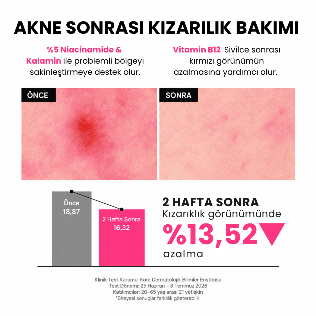 F.A.S.T. Pimple Eraser Roll-On - Kurutucu Akne ve Sivilce Bakım Losyonu 15 ml