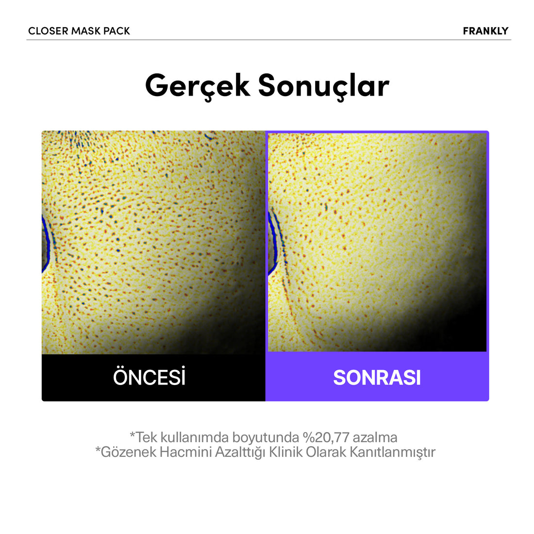 Closer Sheet Mask 22 mL