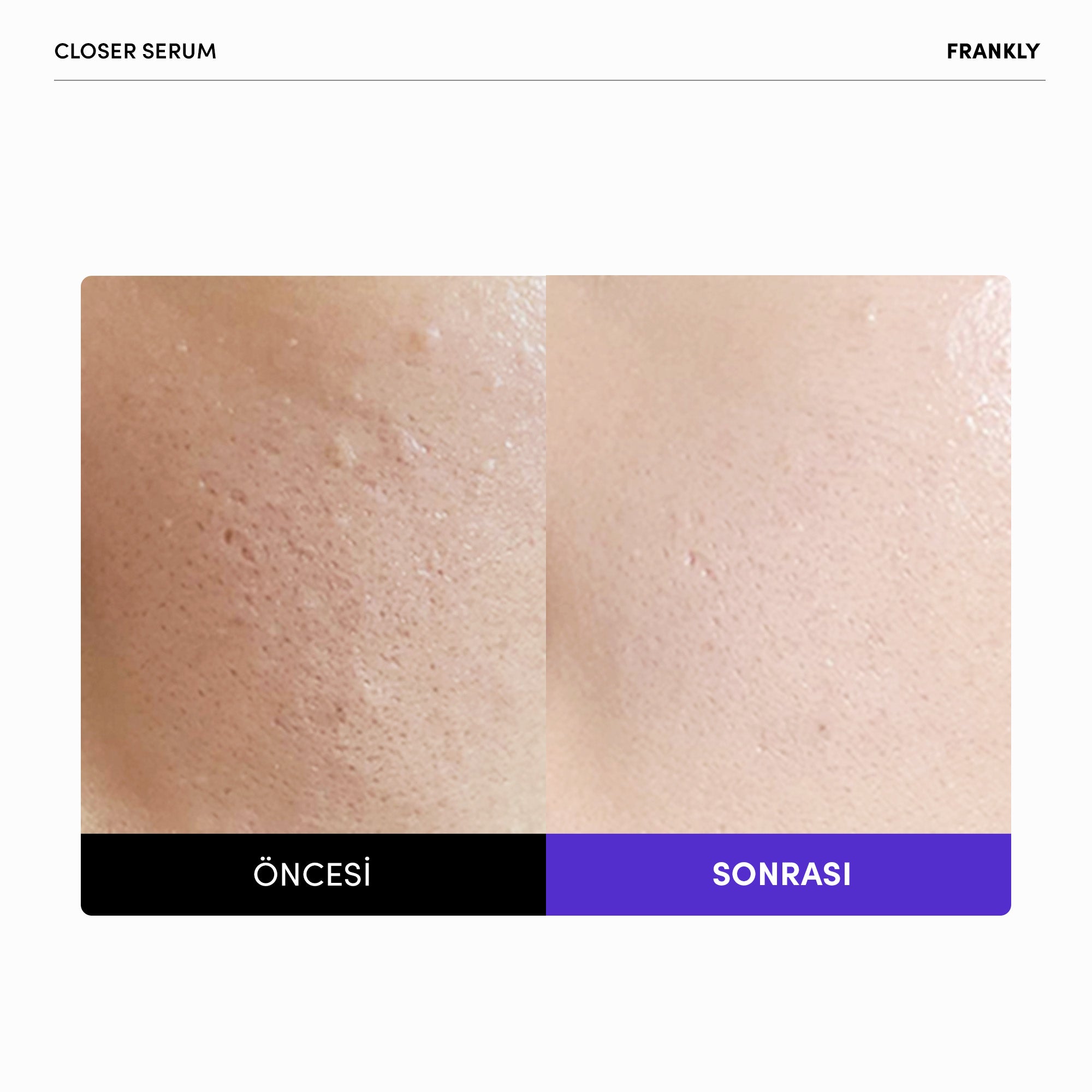 Closer Serum 30 mL