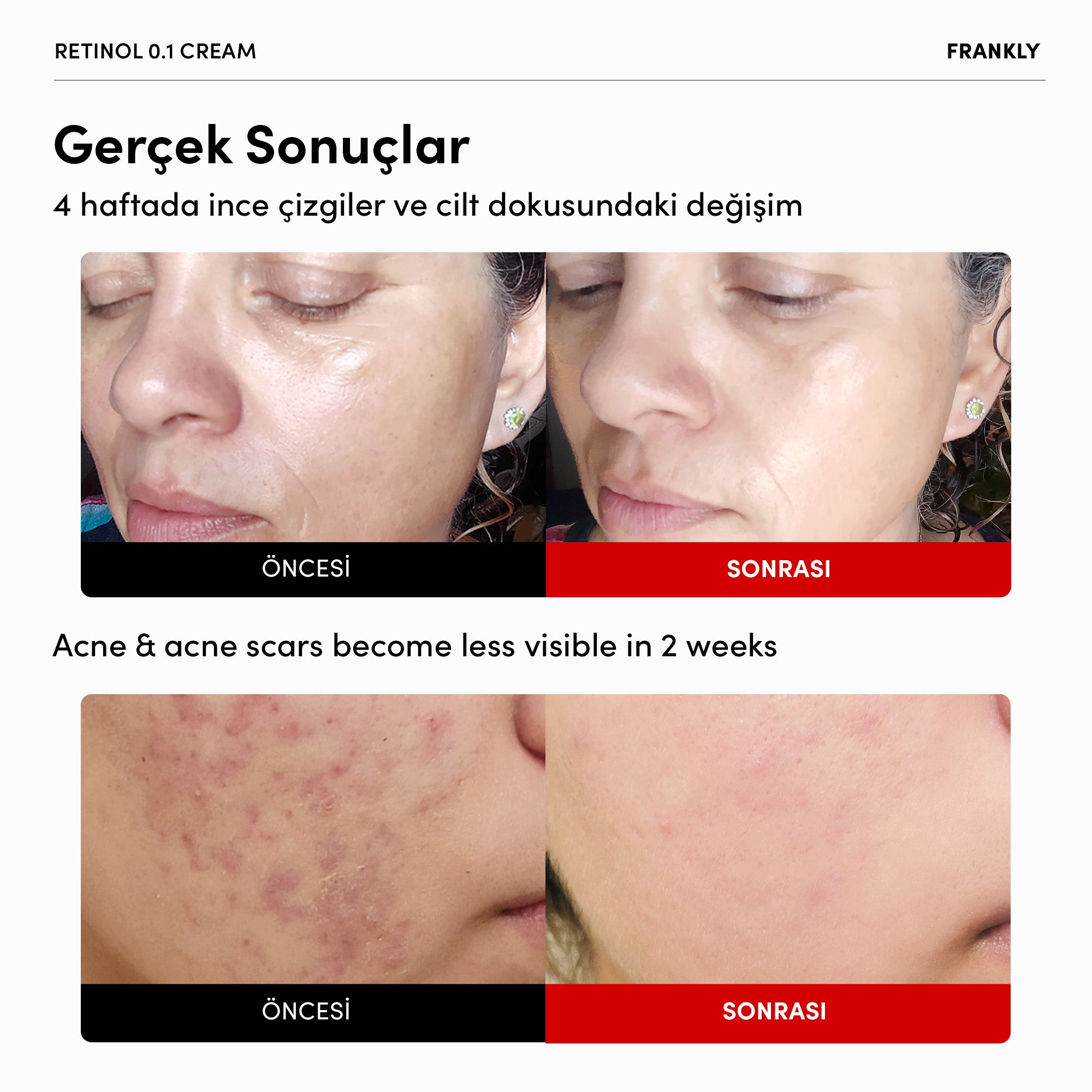 Retinol %0.1 Krem 30 mL